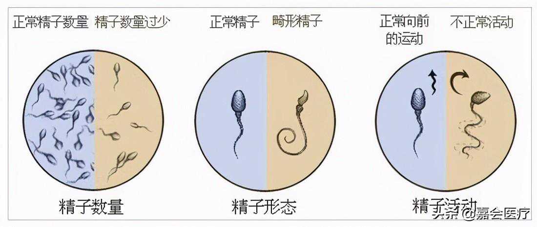 香港验血上哪邮寄,迟迟不见好「孕」？医生提醒：不孕不育，先检查男性