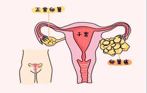 多少人香港验血女孩后打胎了,这三种行为是导致女性不孕不育原因,女性不孕
