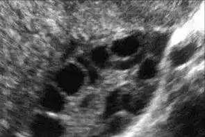 怀孕三个月还能去香港验血看男女吗,为什么医生要给我在月经期做阴道B超检查
