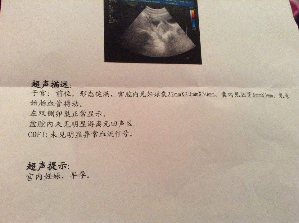 怀孕了香港验血的最佳时间,备孕三年都没怀孕，一次偶然的体检，却圆了小两