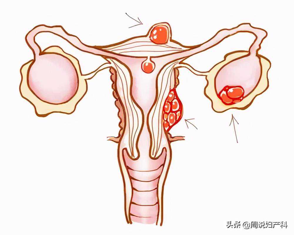 香港验血男孩才准 女孩不准,月经期的子宫内膜厚度多少正常