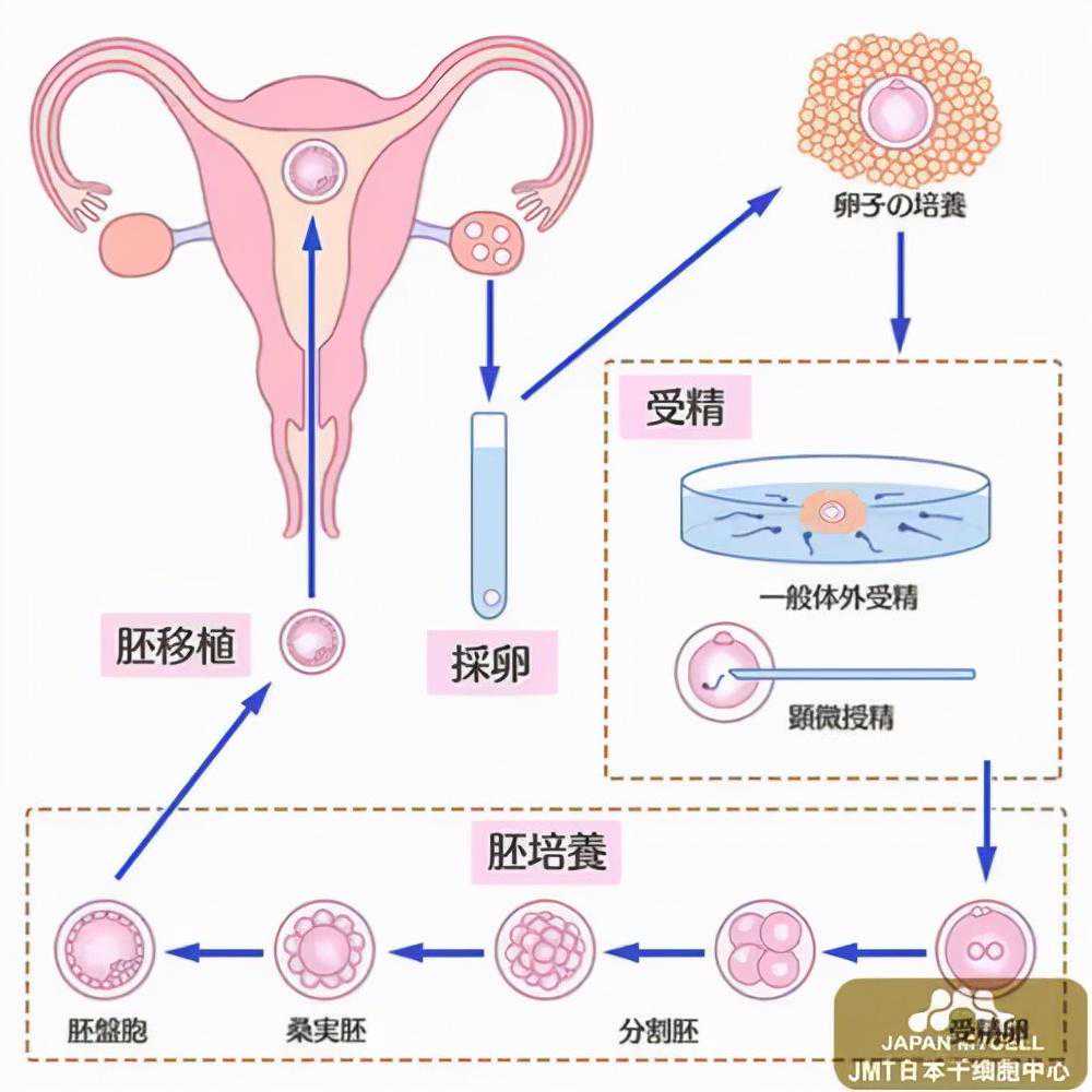 香港验血男孩女孩多少钱,杭州正规辅助生殖助孕机构有哪些？省人民医院能做
