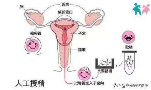 香港孕妇产检验血检查dna,人工授精和试管婴儿并不是一回事?想要生孩子,备孕夫